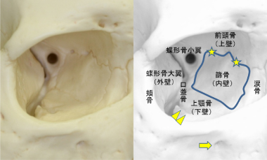 眼窩骨折 群馬県前橋市の眼科形成外科 かしま眼科形成外科クリニック 眼科 眼形成眼窩外科 形成外科