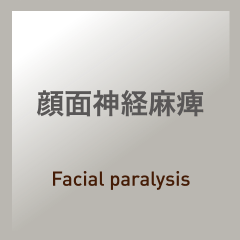 顔面神経麻痺：Facial paralysis