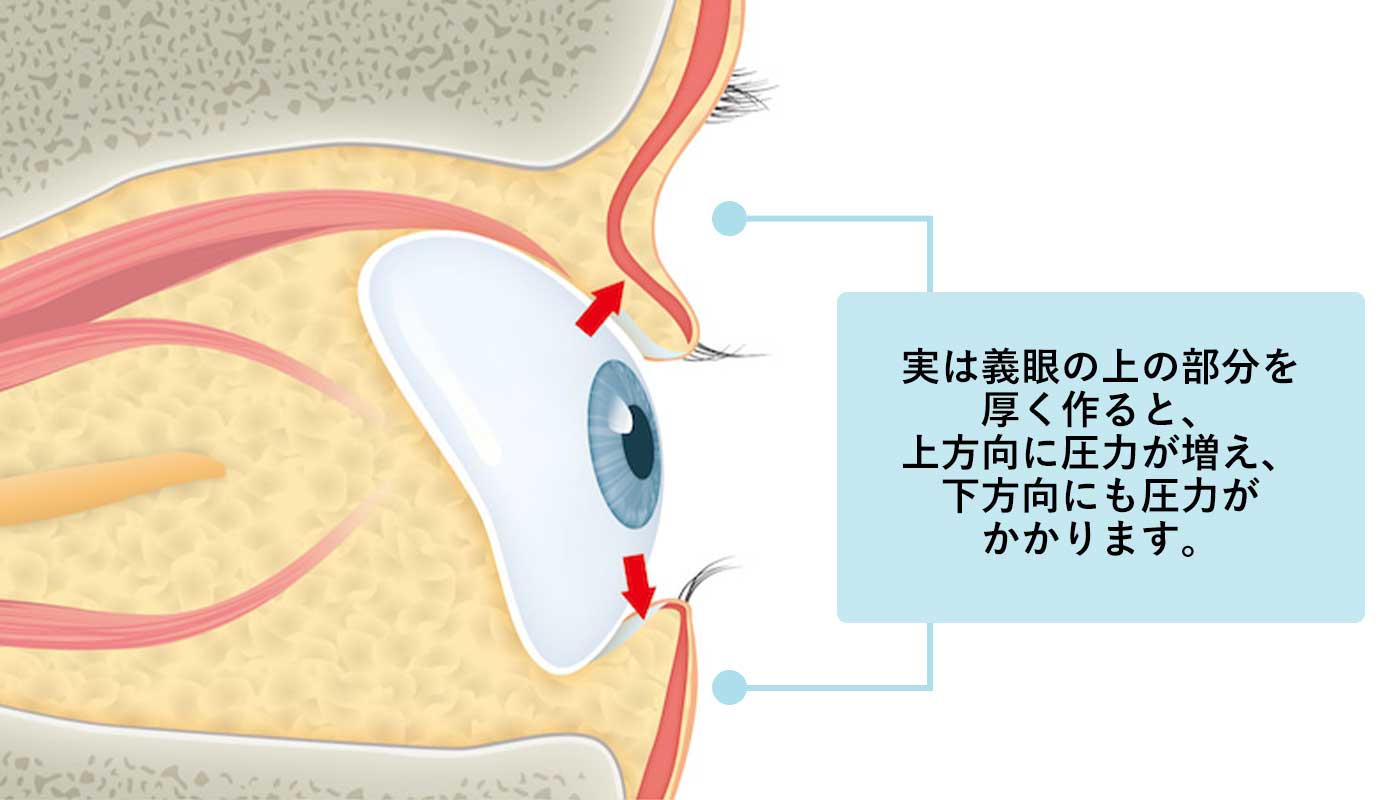 下眼瞼下垂（下まぶたが下がる）と逆さまつげの原因