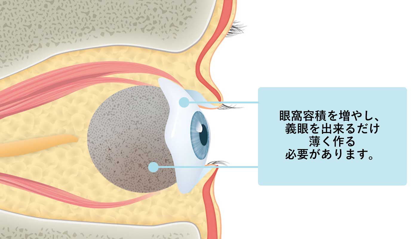 義眼治療する目的とは